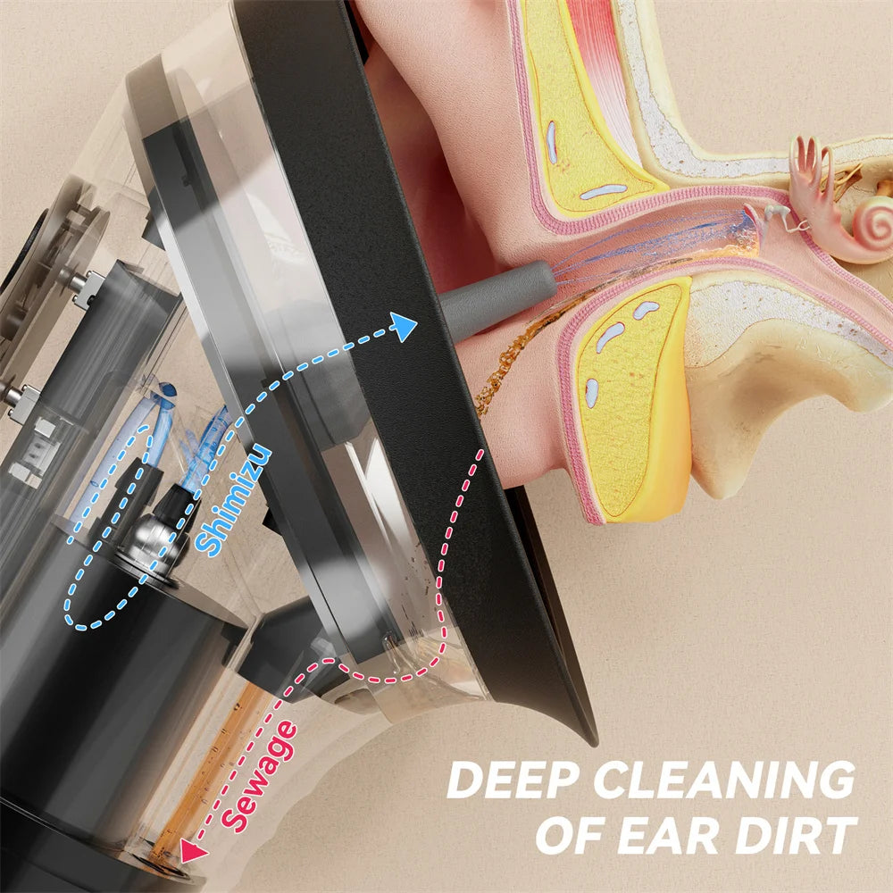 EarClean - Earwax Removal Device with Reservoir and Temperature Sensor