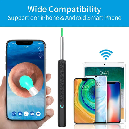 Wireless Ear Cleaner with 1296P Camera, USB-C Charging and WiFi