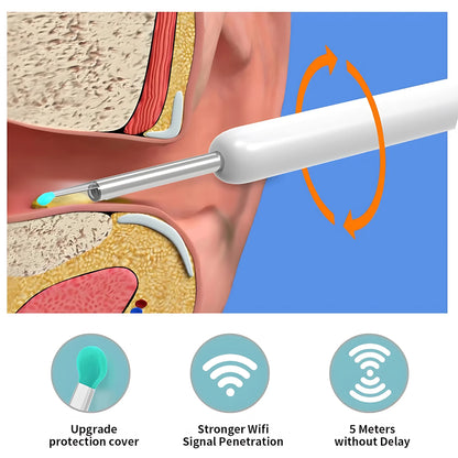 Wireless Ear Cleaner with 1296P Camera, USB-C Charging and WiFi